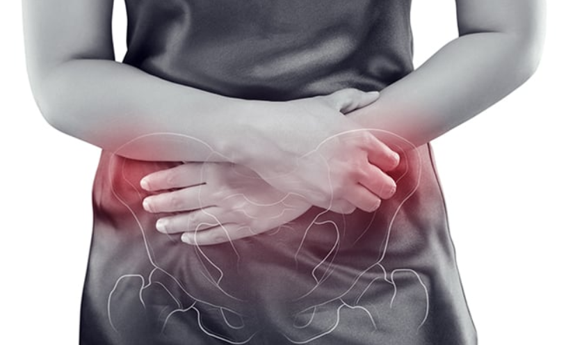 Chronic Pelvic Pain In Women Center For Vascular Medicine