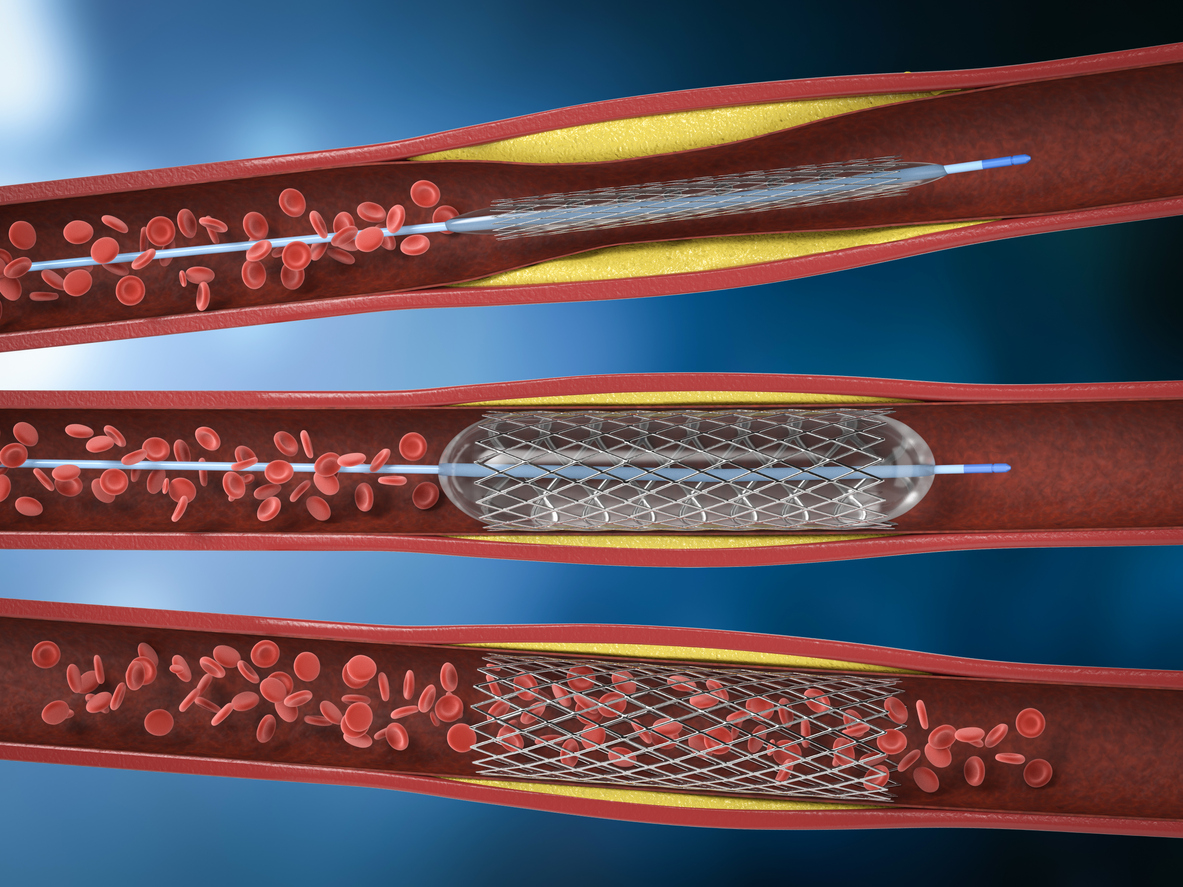 Why Is One Of My Legs Cold To The Touch Center For Vascular Medicine