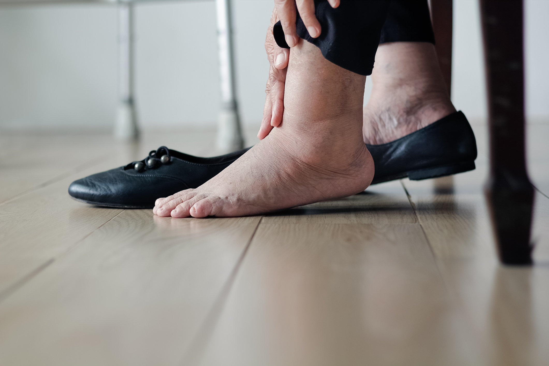 What Can Cause One Swollen Ankle Without Pain CVMUS